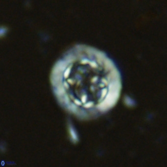 Prediscosphaera decorata VR 11859