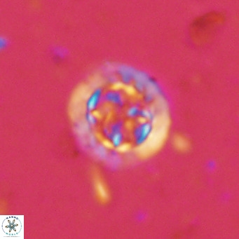 Prediscosphaera decorata VR 11860