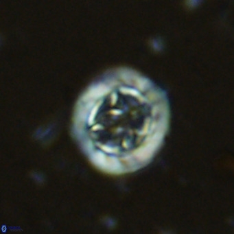 Prediscosphaera decorata VR 11861