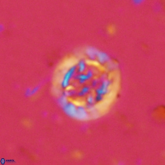 Prediscosphaera decorata VR 11862