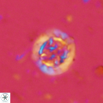 Prediscosphaera decorata VR 11862