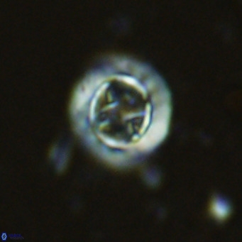 Prediscosphaera decorata VR 11863