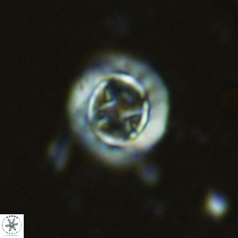 Prediscosphaera decorata VR 11863