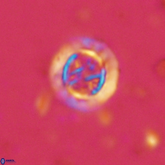 Prediscosphaera decorata VR 11864