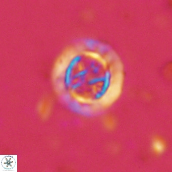 Prediscosphaera decorata VR 11864