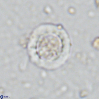 Prediscosphaera decorata VR 11865