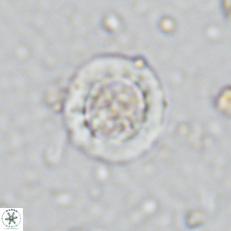 Prediscosphaera decorata VR 11865