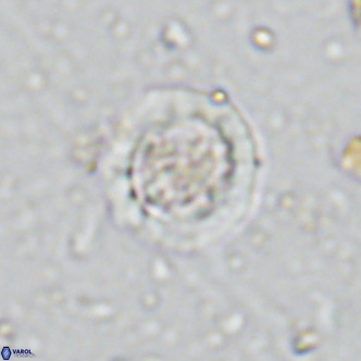 Prediscosphaera decorata VR 11866