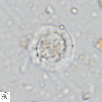 Prediscosphaera decorata VR 11866