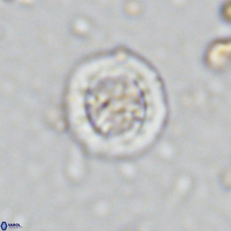 Prediscosphaera decorata VR 11867