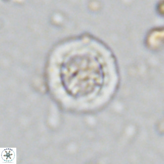 Prediscosphaera decorata VR 11867