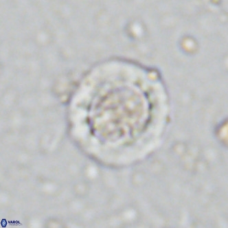 Prediscosphaera decorata VR 11868