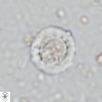 Prediscosphaera decorata VR 11868