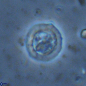 Prediscosphaera decorata VR 11870
