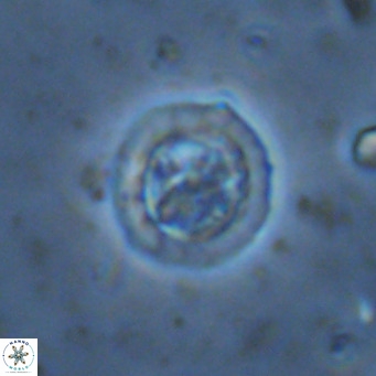 Prediscosphaera decorata VR 11870