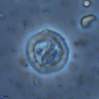 Prediscosphaera decorata VR 11871