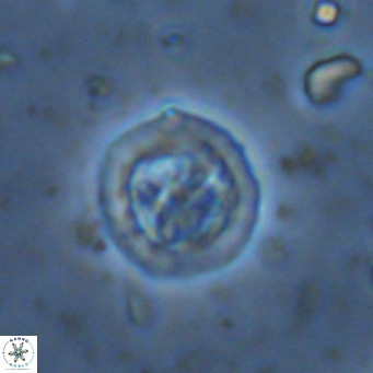 Prediscosphaera decorata VR 11871