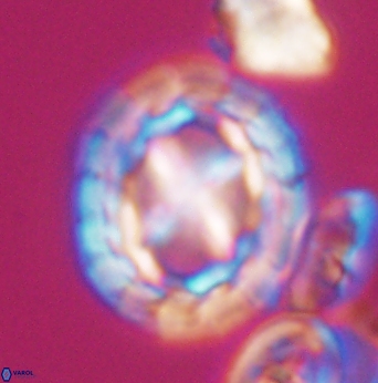 Prediscosphaera desiderograndis 11964
