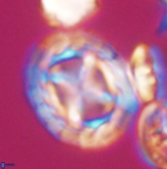 Prediscosphaera desiderograndis 11965
