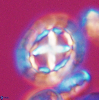 Prediscosphaera desiderograndis 11968