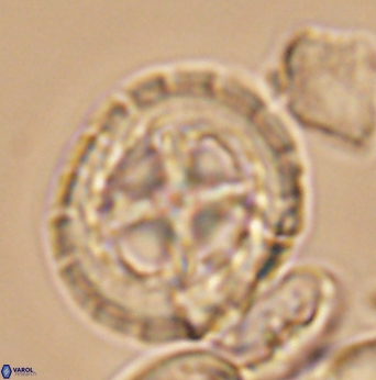 Prediscosphaera desiderograndis 11969
