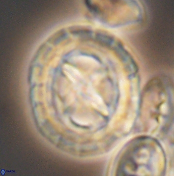 Prediscosphaera desiderograndis 11970