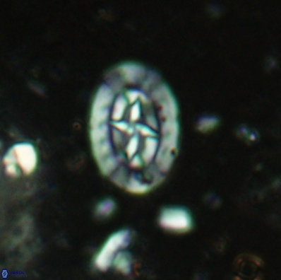Prediscosphaera incohatus 4440