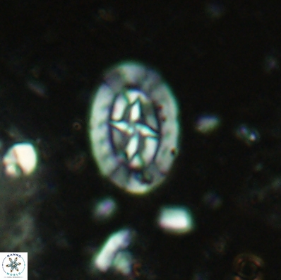 Prediscosphaera incohatus 4440