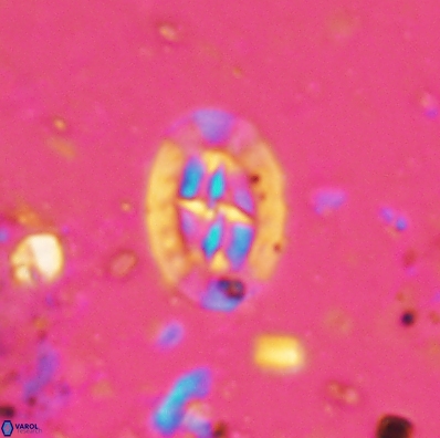 Prediscosphaera incohatus 4441