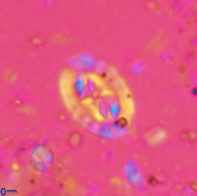 Prediscosphaera incohatus 4442