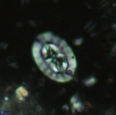 Prediscosphaera incohatus 4443