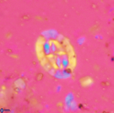 Prediscosphaera incohatus 4445