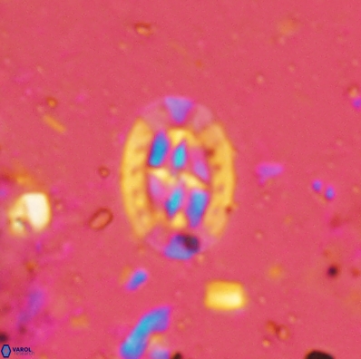 Prediscosphaera incohatus 4449