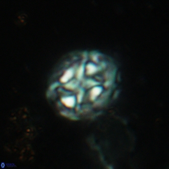 Prediscosphaera lata 6174