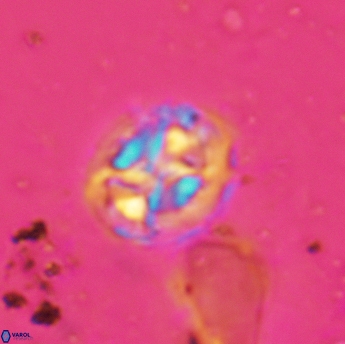 Prediscosphaera lata 6175