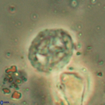 Prediscosphaera lata 6176