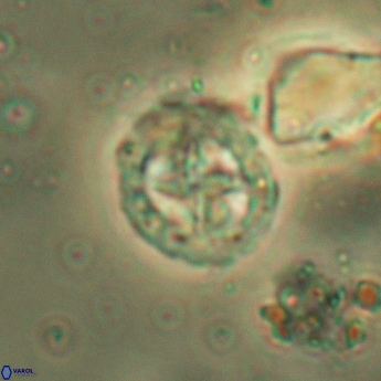 Prediscosphaera lata 6178