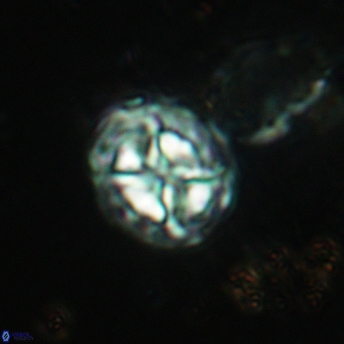 Prediscosphaera lata 6170