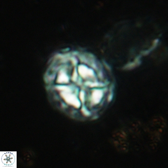 Prediscosphaera lata 6170
