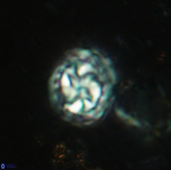 Prediscosphaera lata 6172