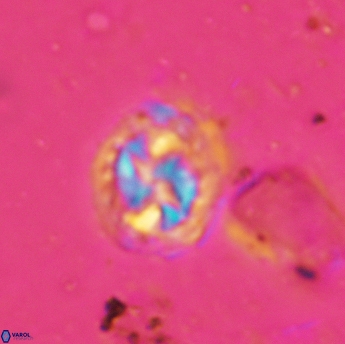 Prediscosphaera lata 6173