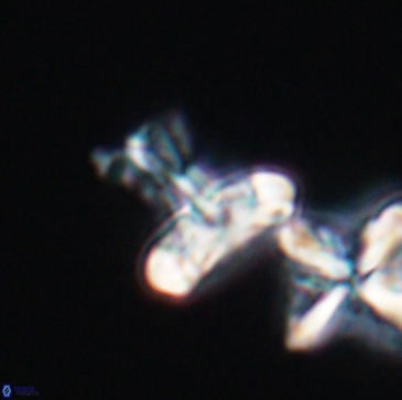 Prediscosphaera majungae 12194