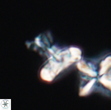 Prediscosphaera majungae 12194