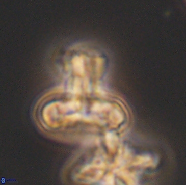 Prediscosphaera majungae 12199