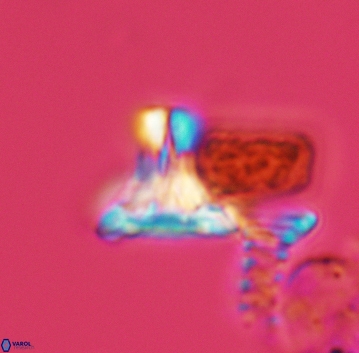 Prediscosphaera majungae 3205