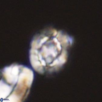 Prediscosphaera majungae 41479