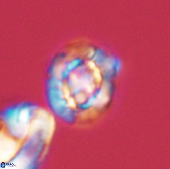 Prediscosphaera majungae 41480