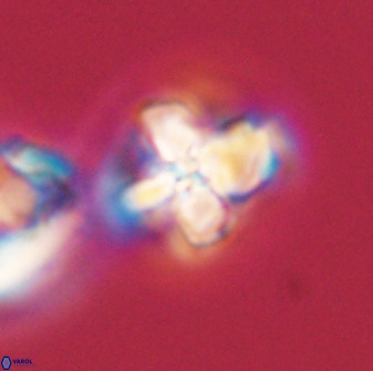 Prediscosphaera majungae 41481