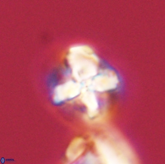 Prediscosphaera majungae 41484