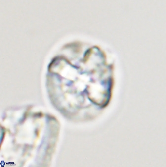 Prediscosphaera majungae 41486